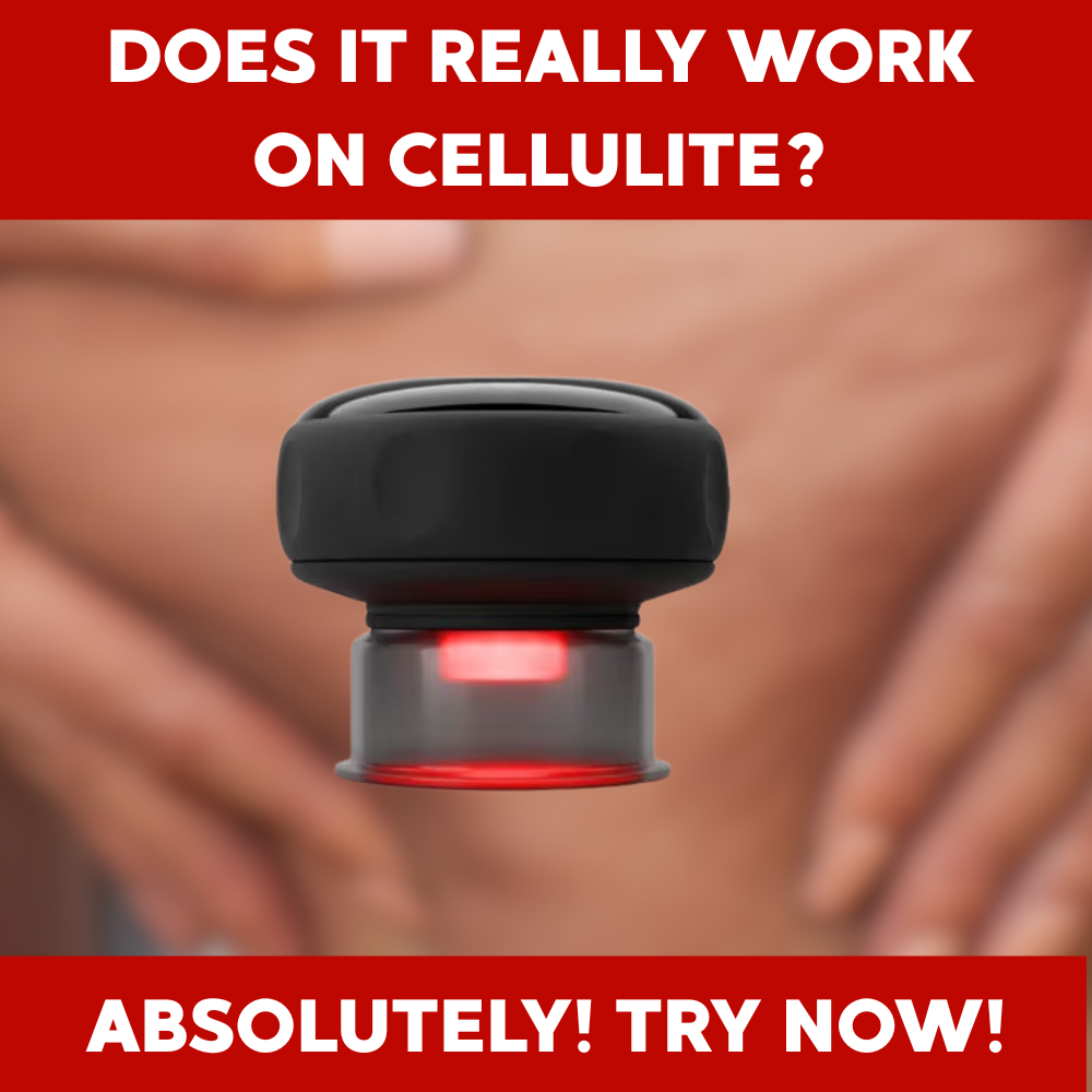 PulseCup 4-in-1 Cupping Massager